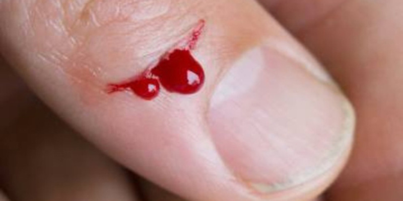 Giải mã giấc mơ về máu trước khi giải đáp ngủ mơ thấy máu đánh số mấy