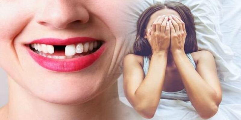 Ngủ mơ thấy răng rụng là điềm gì?